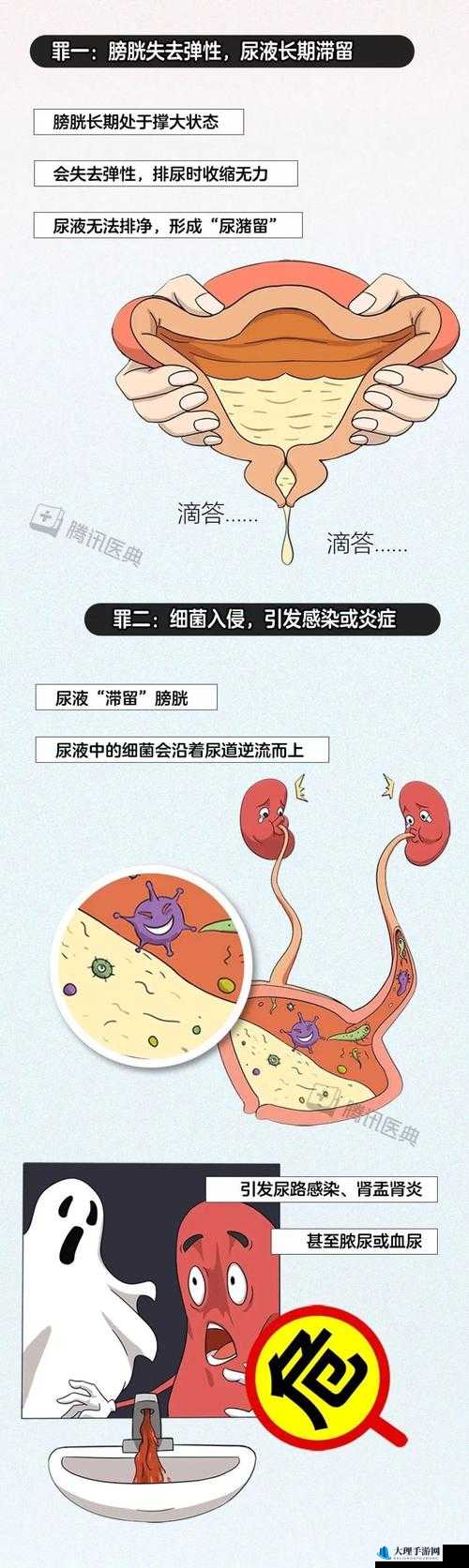 小便刚要尿出来就自动憋回去：探究这种特殊生理现象的原因及影响